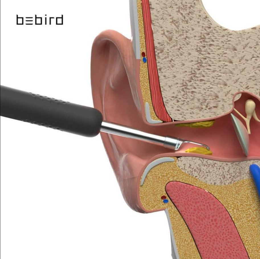 Bebird R1 Smart Visual Ear Sticks Endoscope Ear Picker Tool Set - White.